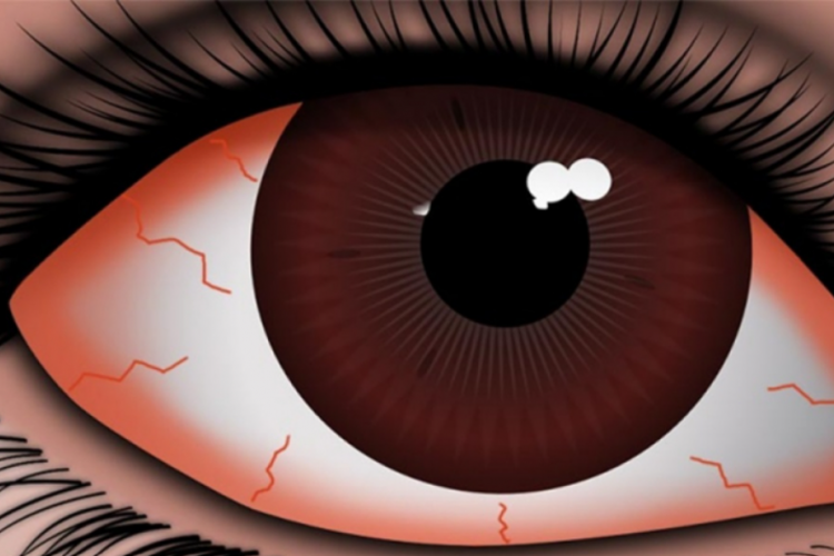 Mucus fishing the risks and symptoms Lenstore.co.uk